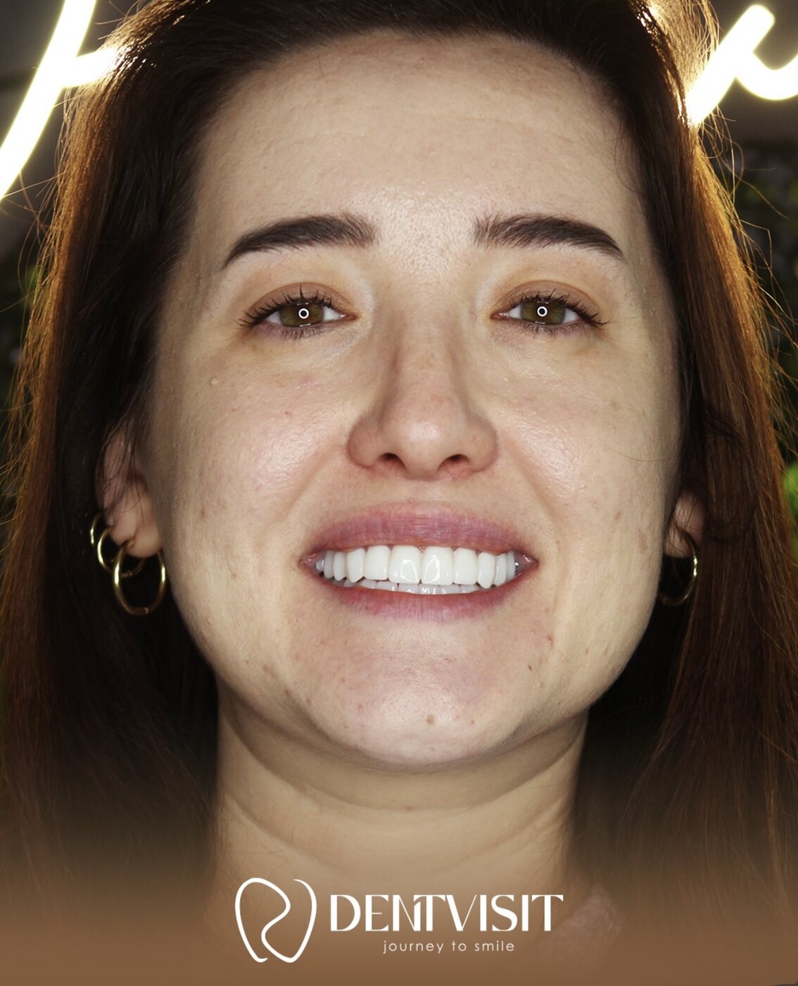 DentVisit — Преображение улыбки
