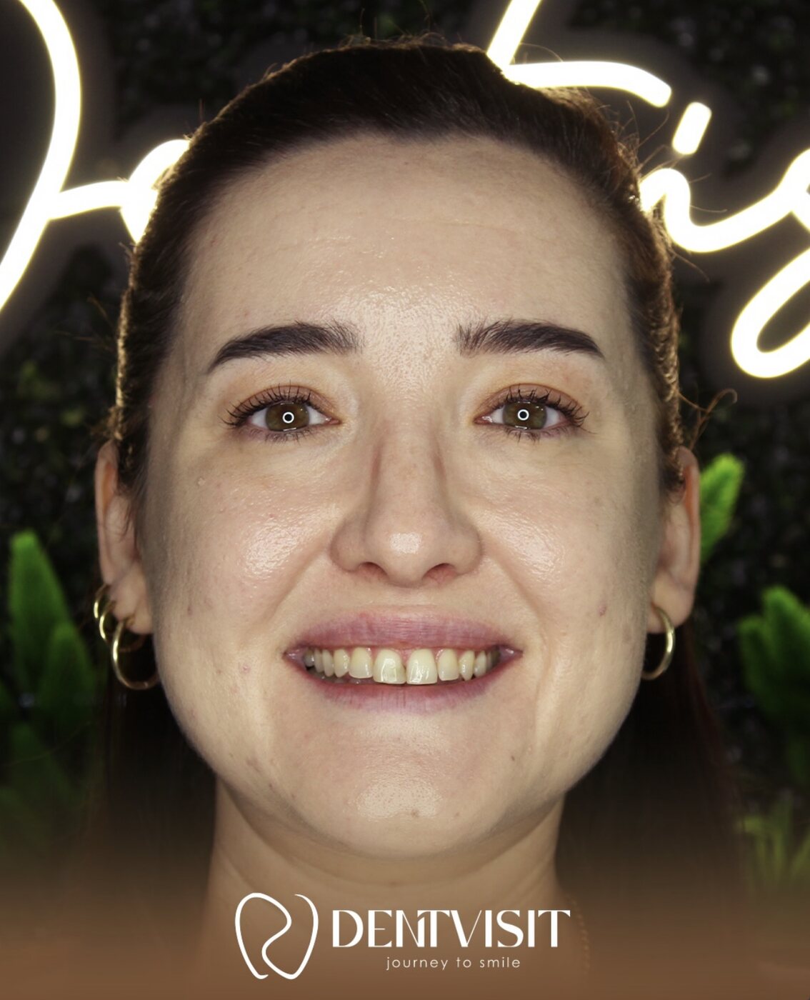 DentVisit — Новая улыбка